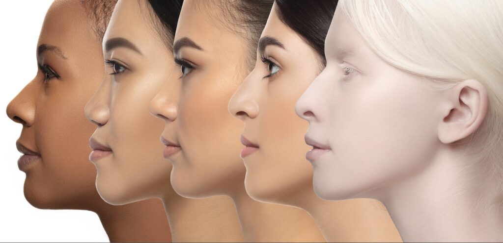 Ethnic Rhinoplasty: Depiction of 5 women in different shades of skin color and ethnicity