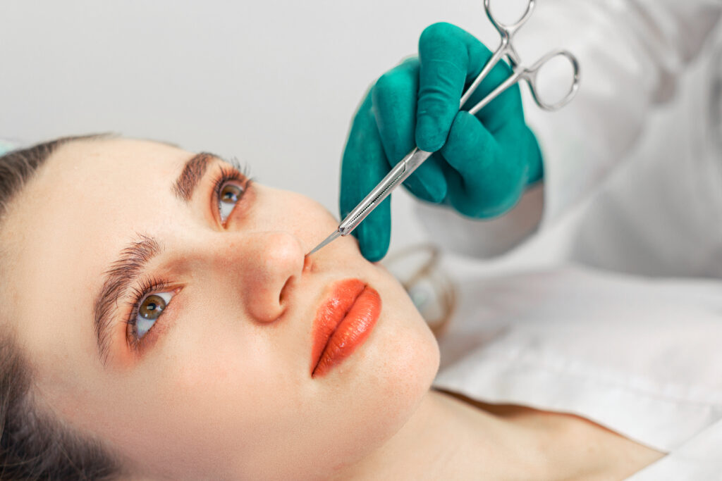 Laser Nose Surgery Procedure and Cost