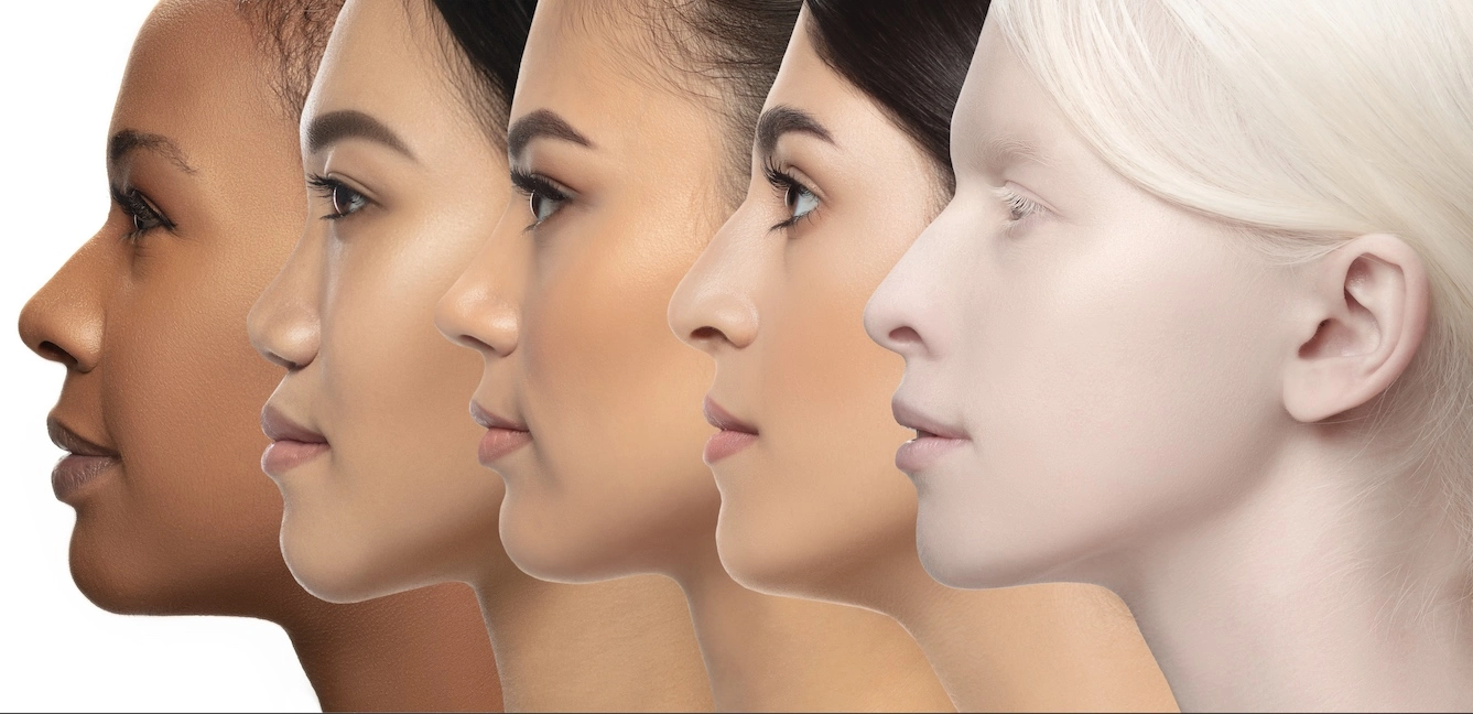 How Ethnic Rhinoplasty is Different for African American Noses? Banner