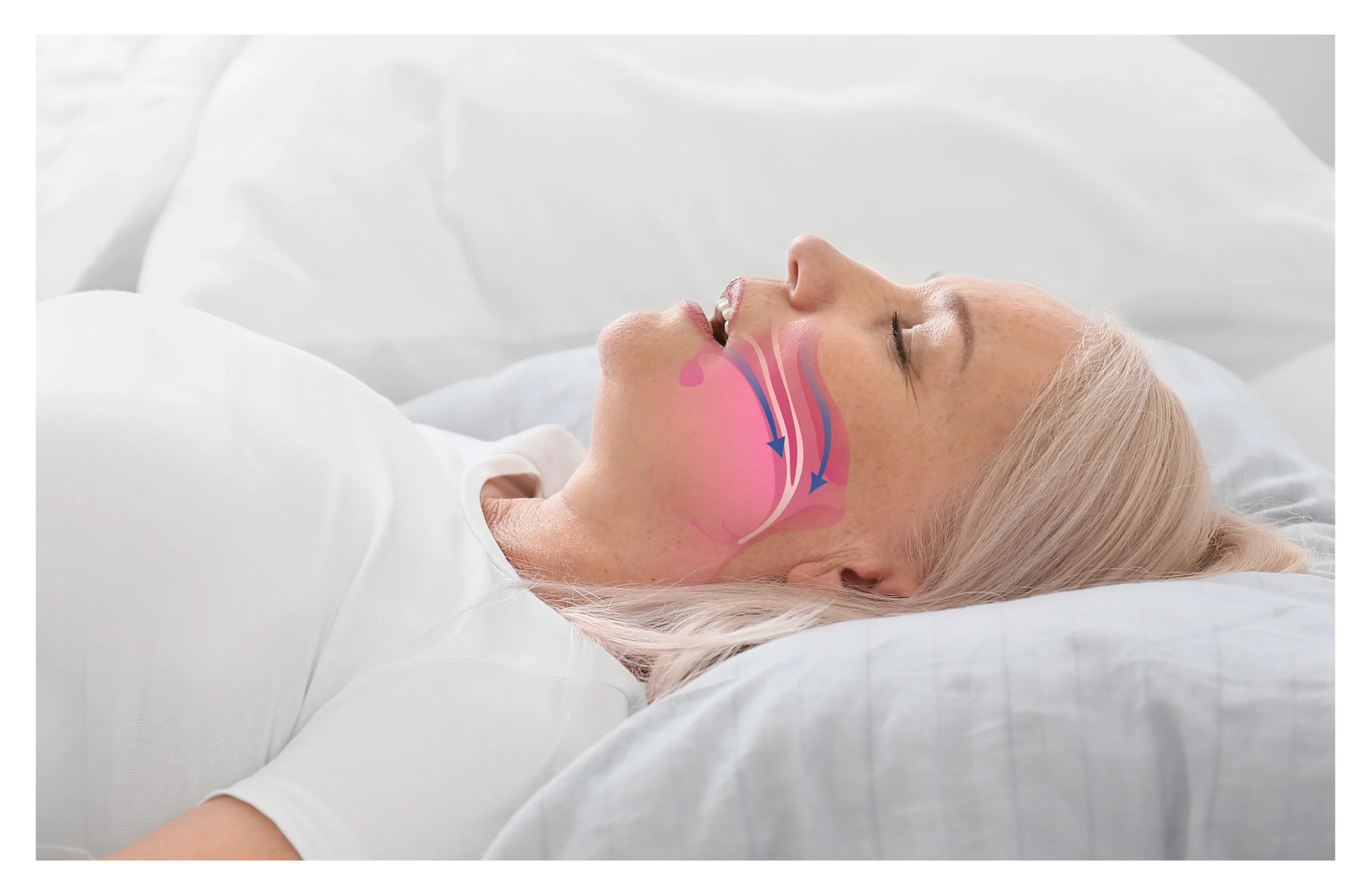 How Weight Loss After Sleep Apnea Treatment Can Improve Your Quality of Life? Banner