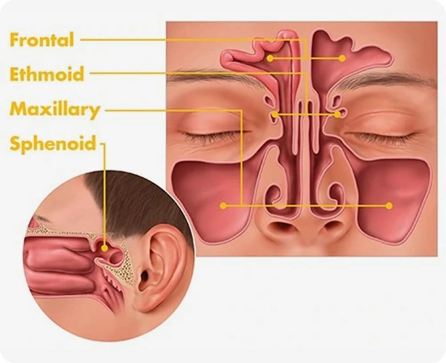 What Is a Sinus Headache Treatment Houston, TX Banner