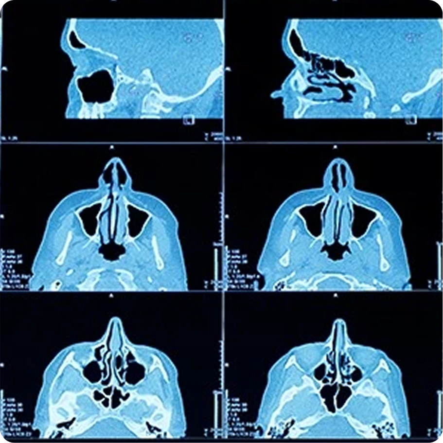 Deviated Septum ENT in Houston, TX Banner